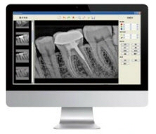 /media/sensore-radiografico-2.jpg