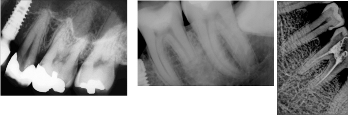 /media/sensore-radiografico-4.jpg